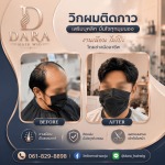 วิกผมปิดผมบางติดกาว - Dara Hairwig