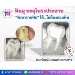 คลินิกรักษารากฟัน สมุทรปราการ - คลินิกจัดฟัน เอ.ซี.