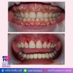 คลินิกศัลยกรรมช่องปาก สมุทรปราการ - คลินิกจัดฟัน เอ.ซี.