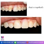 คลินิกทำฟัน อุดฟัน ขูดหินปูน สมุทรปราการ - คลินิกจัดฟัน เอ.ซี.