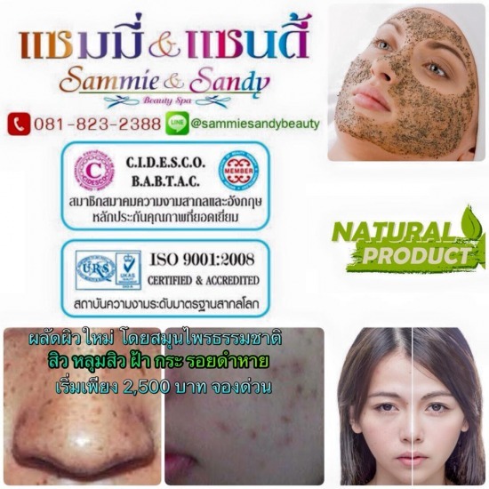 ขจัดสิวหลุมสิว ขจัดสิวหลุมสิว 